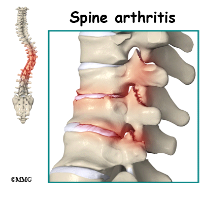 Surgical Management - Sankalp Spine Hospital